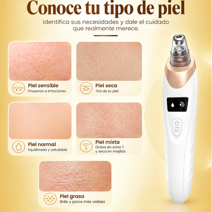 Removedor de Puntos Negros sin Dolor, Succión Ajustable